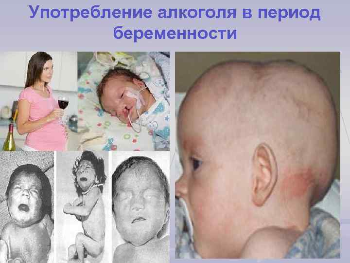 Употребление алкоголя в период беременности 