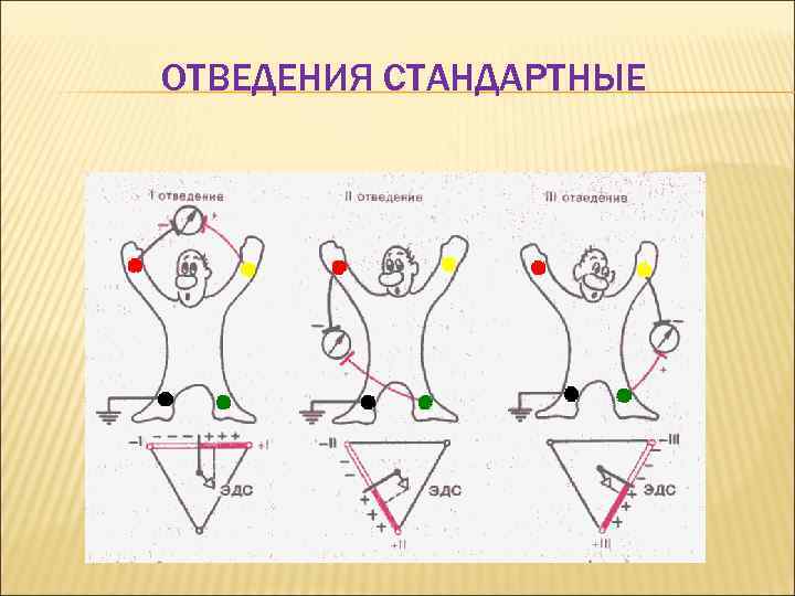 ОТВЕДЕНИЯ СТАНДАРТНЫЕ 