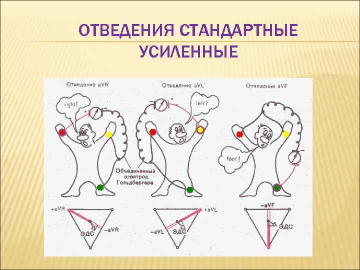 ОТВЕДЕНИЯ СТАНДАРТНЫЕ УСИЛЕННЫЕ 