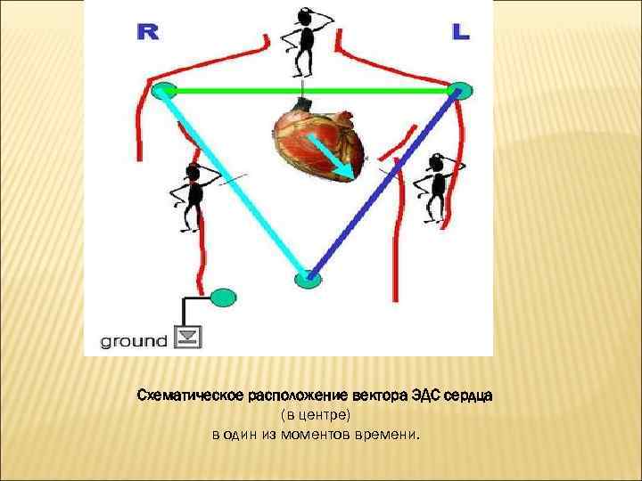 Схематическое расположение вектора ЭДС сердца (в центре) в один из моментов времени. 