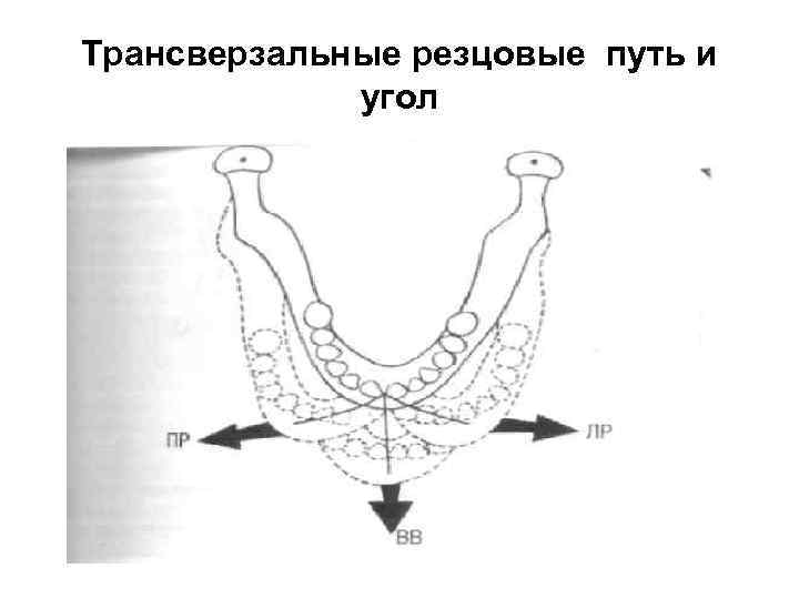 Угол пути. Трансверзальный резцовый путь угол. Угол трансверзального суставного пути угол Беннета. Схему углов трансверзальных суставного и резцового путей. Угол трансверзального резцового пути Готический.