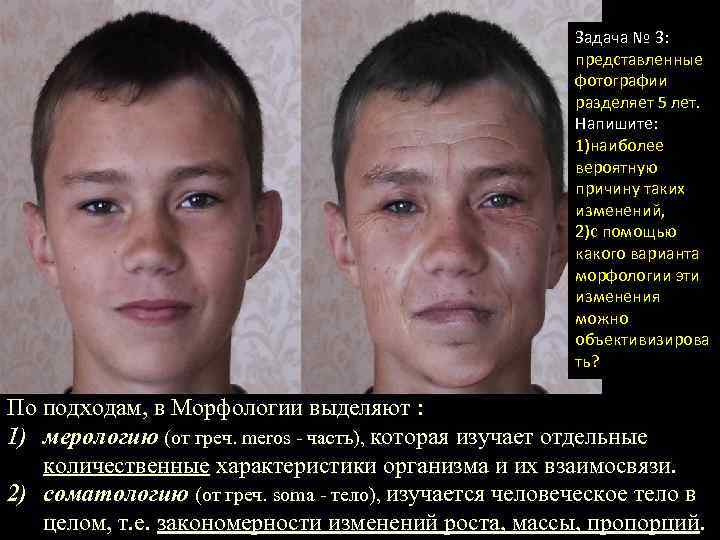 Задача № 3: представленные фотографии разделяет 5 лет. Напишите: 1)наиболее вероятную причину таких изменений,