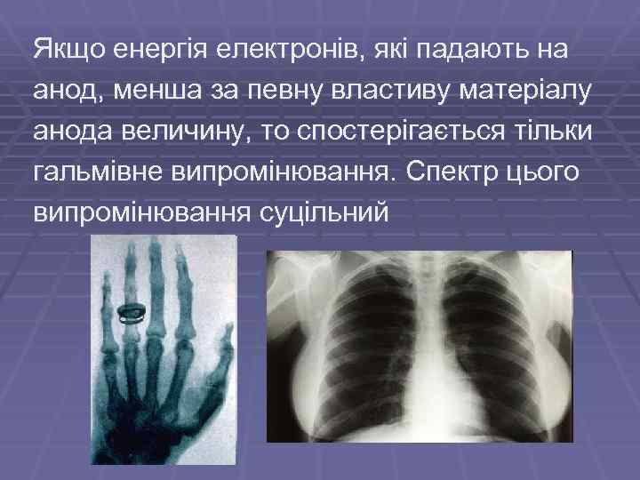 Якщо енергія електронів, які падають на анод, менша за певну властиву матеріалу анода величину,