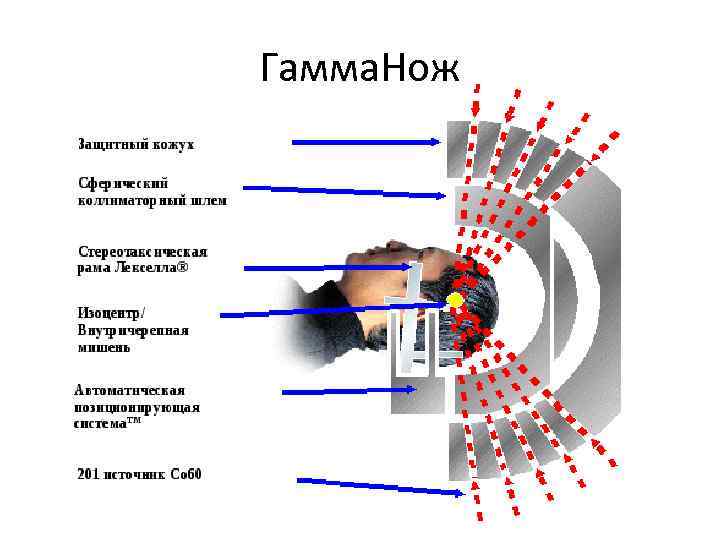 Гамма. Нож 