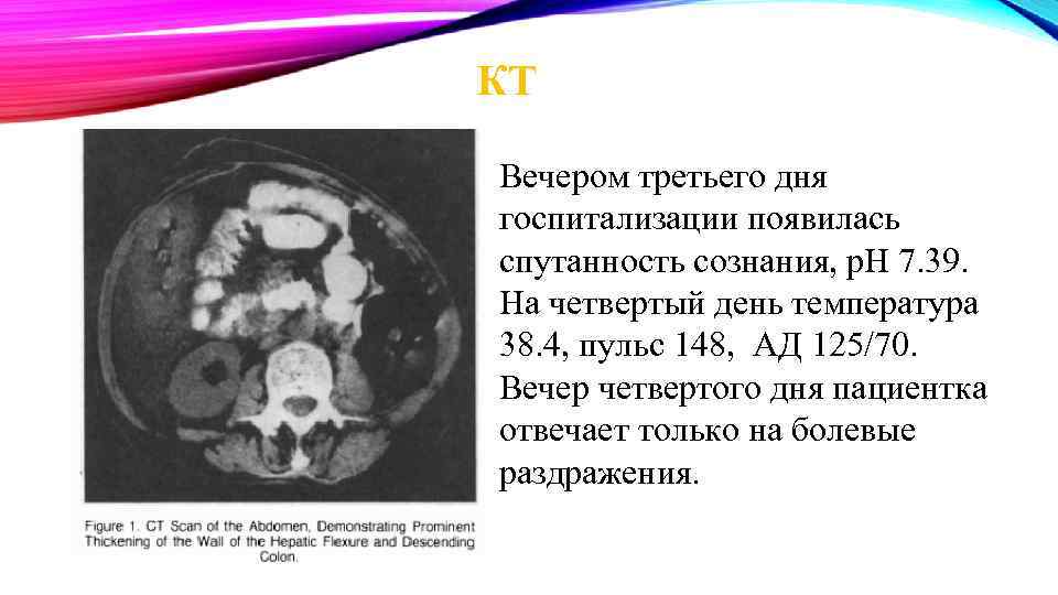 КТ Вечером третьего дня госпитализации появилась спутанность сознания, p. H 7. 39. На четвертый