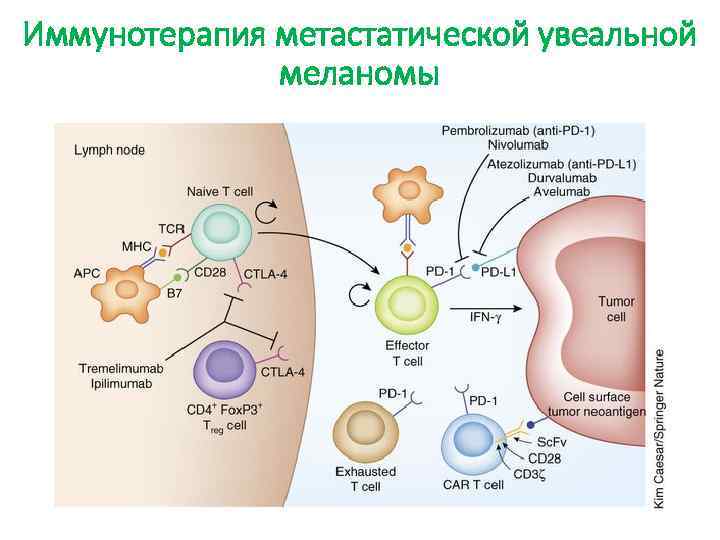 Иммунотерапия метастатической увеальной меланомы 
