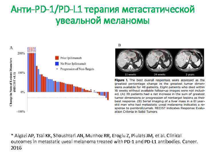 Анти-PD-1/PD-L 1 терапия метастатической увеальной меланомы * Algazi AP, Tsai KK, Shoushtari AN, Munhoz