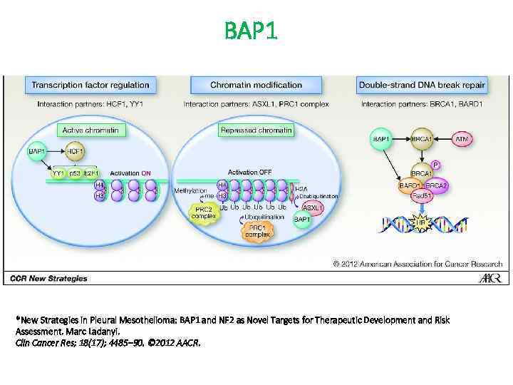 BAP 1 *New Strategies in Pleural Mesothelioma: BAP 1 and NF 2 as Novel