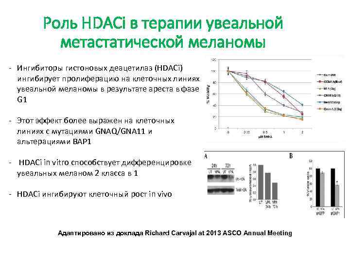 Роль HDACi в терапии увеальной метастатической меланомы - Ингибиторы гистоновых деацетилаз (HDACi) ингибирует пролиферацию