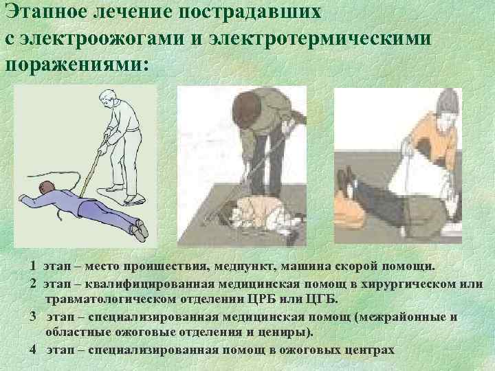 Этапное лечение пострадавших с электроожогами и электротермическими поражениями: 1 этап – место проишествия, медпункт,