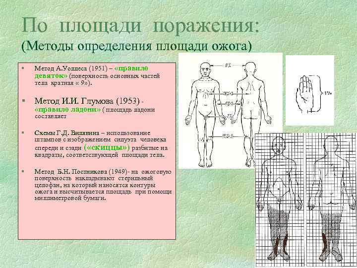 По площади поражения: (Методы определения площади ожога) § Метод А. Уоллеса (1951) – «правило