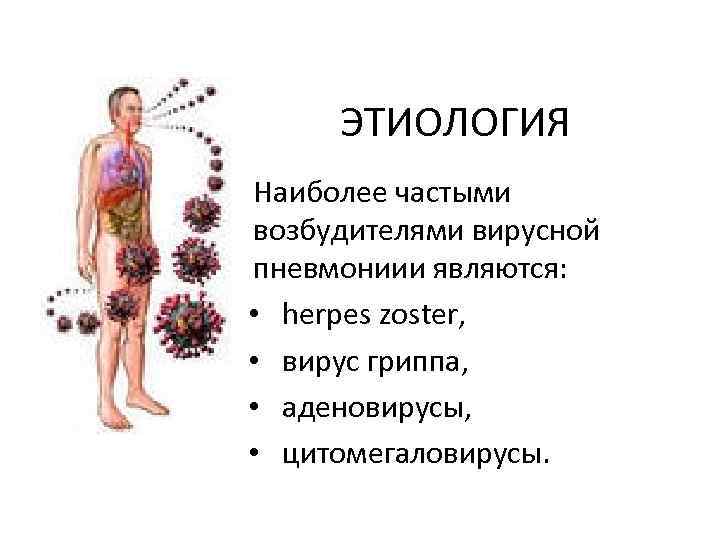 ЭТИОЛОГИЯ Наиболее частыми возбудителями вирусной пневмониии являются: • herpes zoster, • вирус гриппа, •