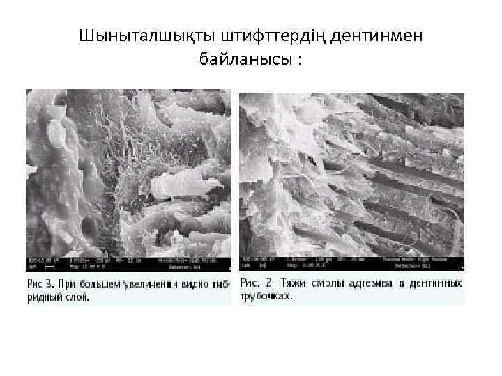 Шыныталшықты штифттердің дентинмен байланысы : 