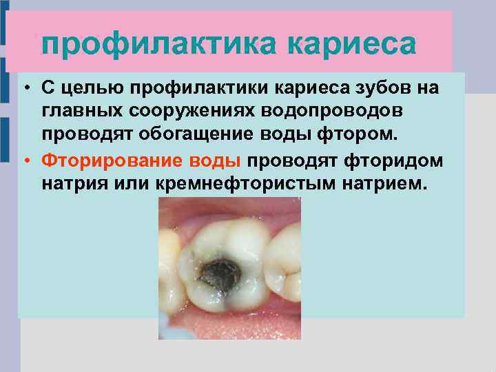 профилактика кариеса • С целью профилактики кариеса зубов на главных сооружениях водопроводов проводят обогащение
