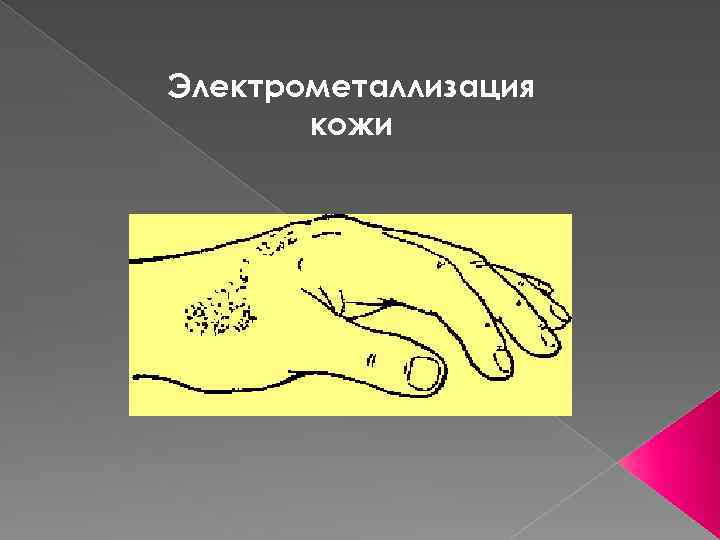 Электрометаллизация кожи 