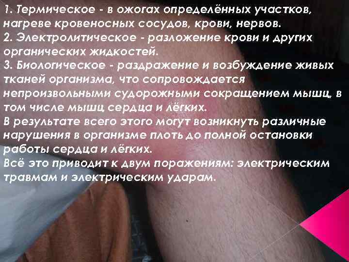 1. Термическое - в ожогах определённых участков, нагреве кровеносных сосудов, крови, нервов. 2. Электролитическое