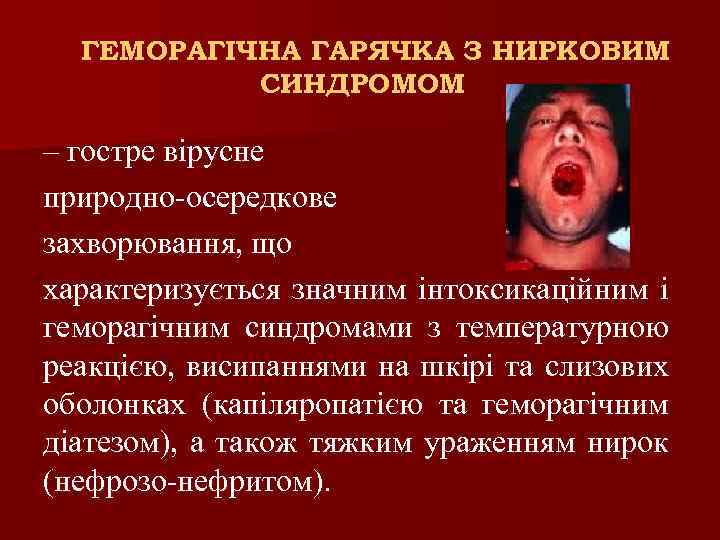 ГЕМОРАГІЧНА ГАРЯЧКА З НИРКОВИМ СИНДРОМОМ – гостре вірусне природно-осередкове захворювання, що характеризується значним інтоксикаційним