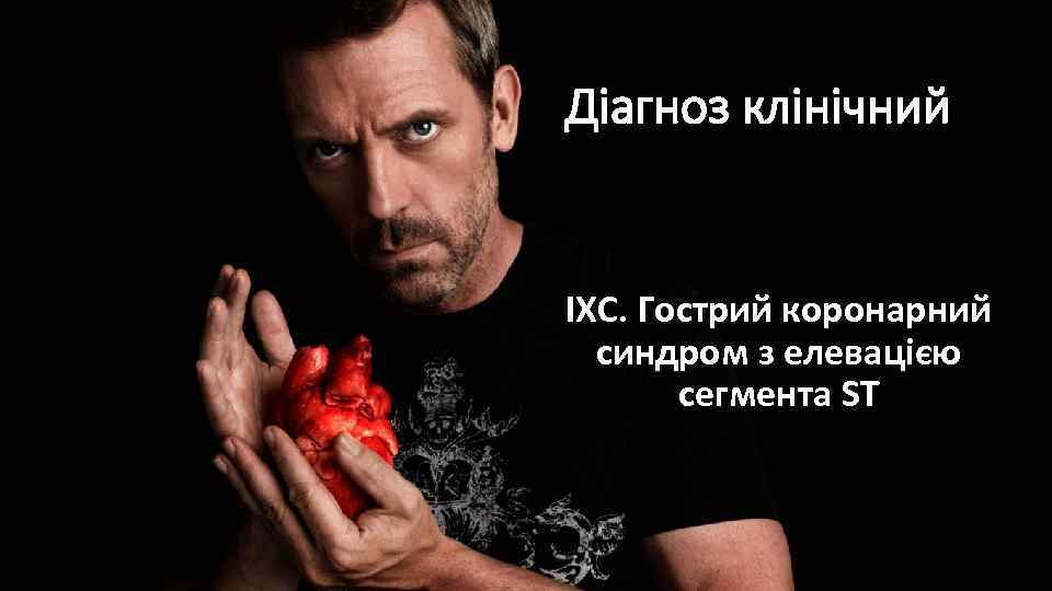 Діагноз клінічний ІХС. Гострий коронарний синдром з елевацією сегмента ST 