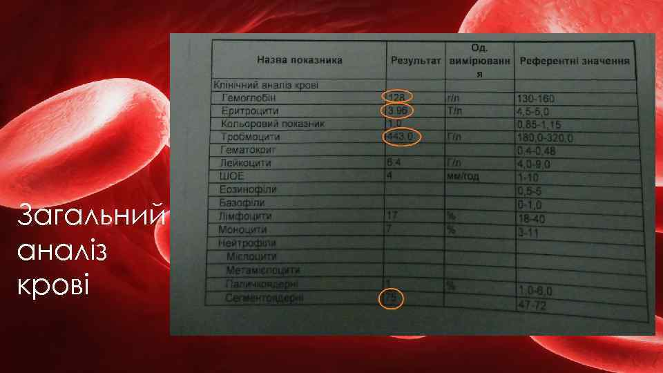 Загальний аналіз крові 