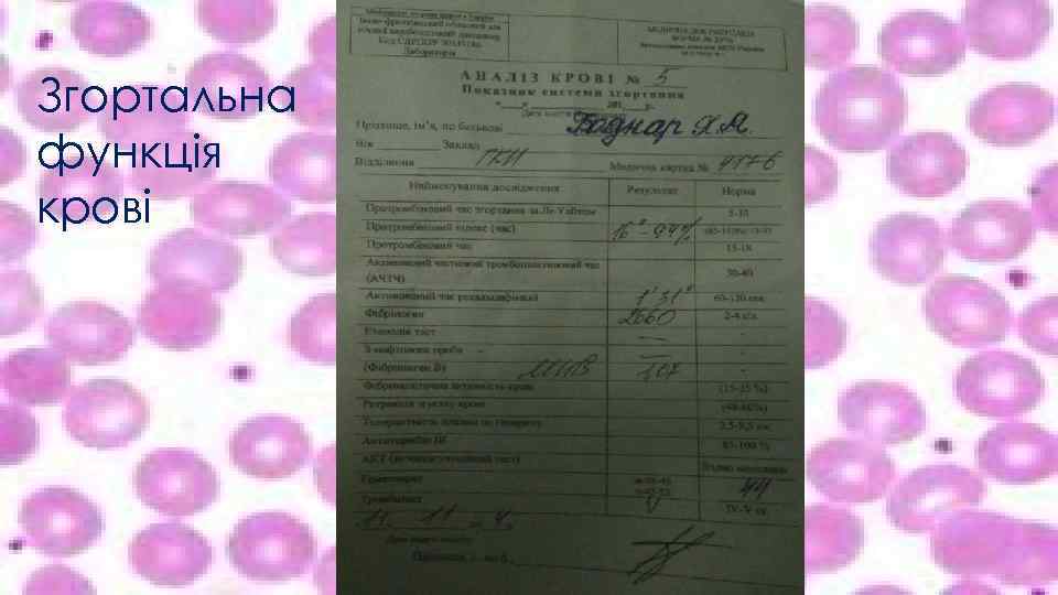 Згортальна функція крові 