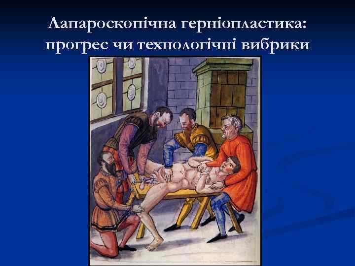 Лапароскопічна герніопластика: прогрес чи технологічні вибрики 