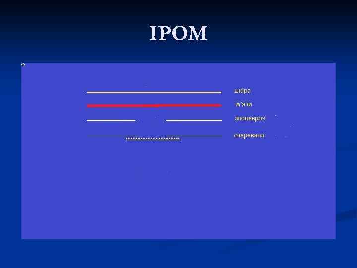 IPOM 