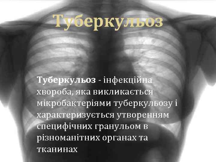 Туберкульоз - інфекційна хвороба, яка викликається мікробактеріями туберкульозу і характеризується утворенням специфічних гранульом в