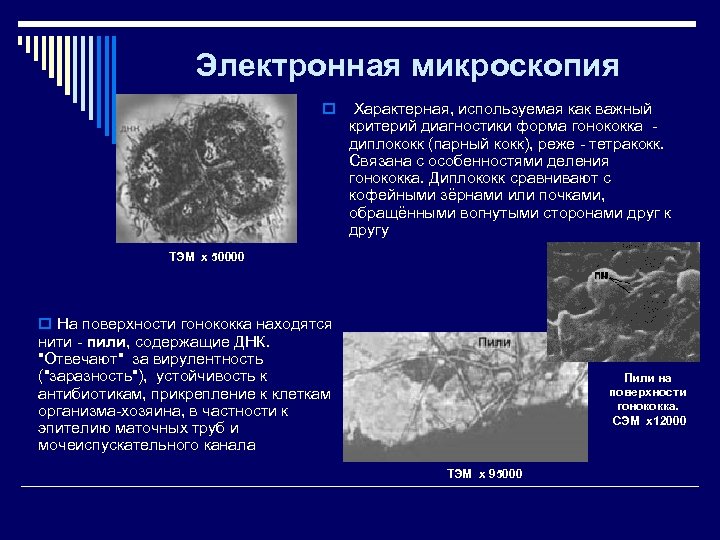 Электронная микроскопия o Характерная, используемая как важный критерий диагностики форма гонококка - диплококк (парный