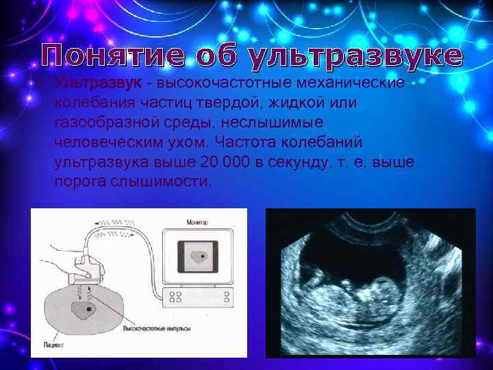 Какая частота колебаний ультразвука