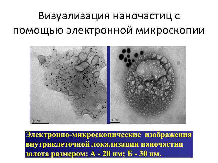 Визуализация наночастиц с помощью электронной микроскопии 