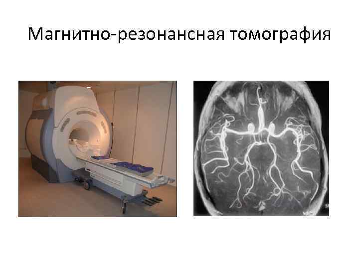 Магнитно резонансная томография 