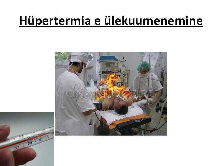 Hüpertermia e ülekuumenemine 