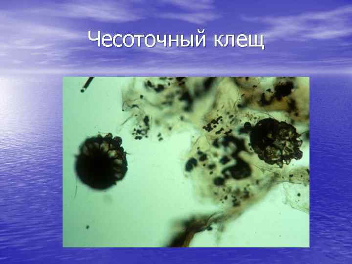 Чесоточный клещ 