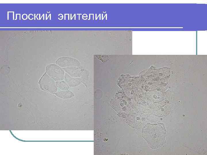 Плоский эпителий 