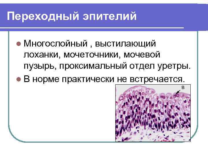 Переходный эпителий l Многослойный , выстилающий лоханки, мочеточники, мочевой пузырь, проксимальный отдел уретры. l