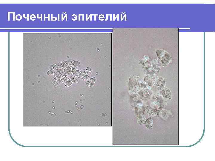 Почечный эпителий 