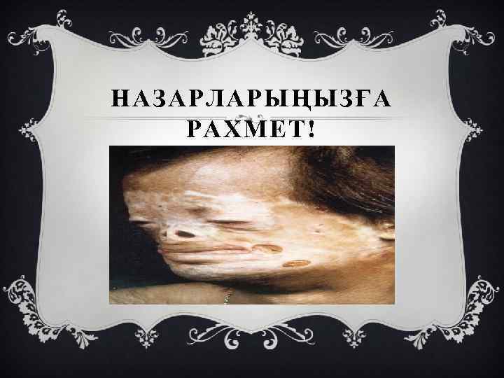 НАЗАРЛАРЫҢЫЗҒА РАХМЕТ! 