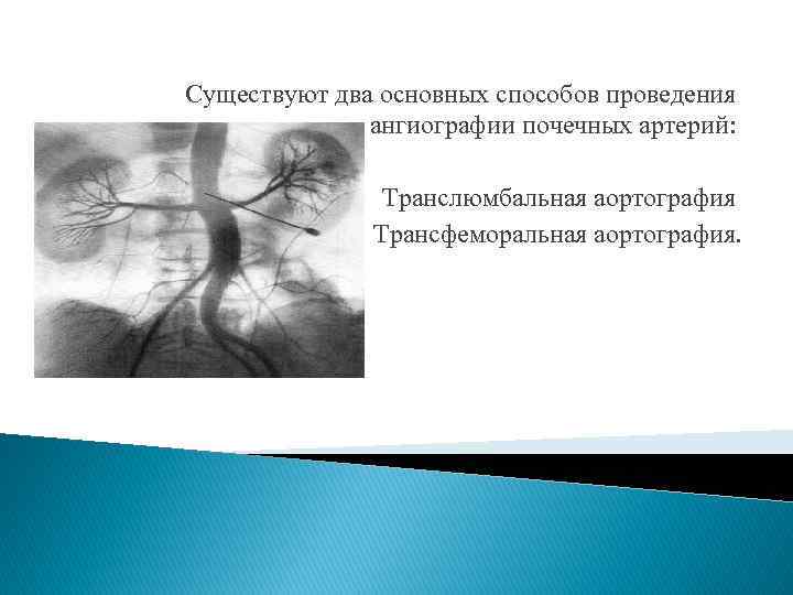 Существуют два основных способов проведения ангиографии почечных артерий: Транслюмбальная аортография Трансфеморальная аортография. 