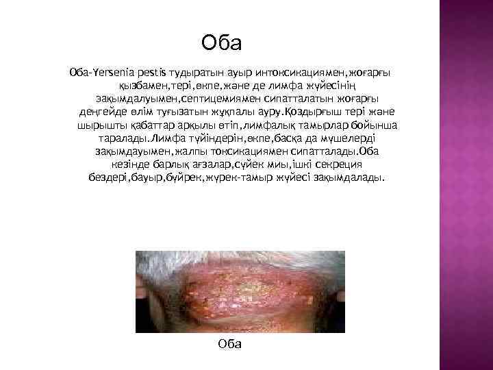 Оба Оба-Yersenia pestis тудыратын ауыр интоксикациямен, жоғарғы қызбамен, тері, өкпе, және де лимфа жүйесінің
