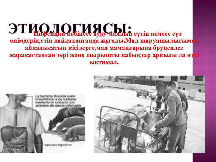ЭТИОЛОГИЯСЫ: сүтін немесе сүт Инфекция көбінесе ауру малдың өнімдерін, етін пайдаланғанда жұғады. Мал шаруашылығымен