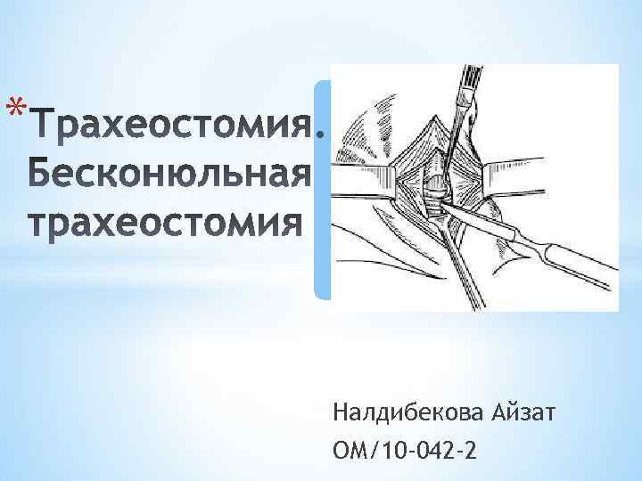 * Налдибекова Айзат ОМ/10 -042 -2 