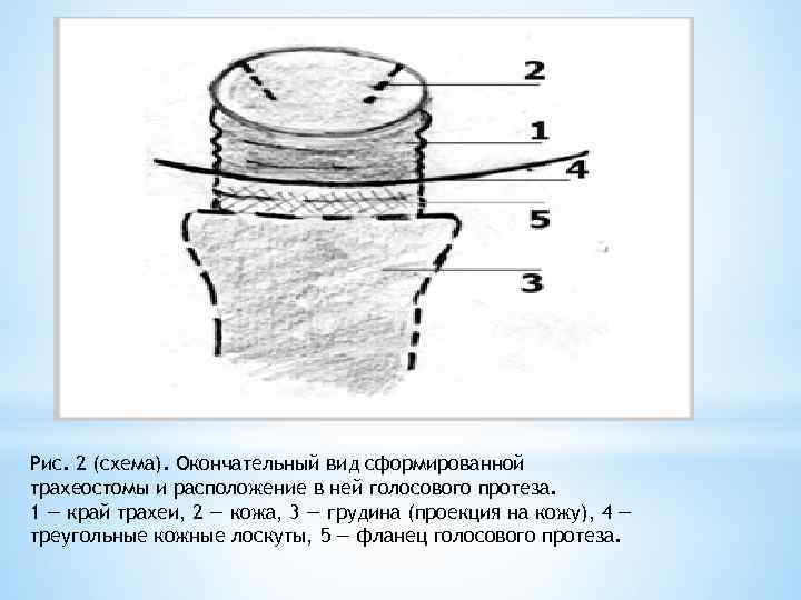 Окончательный вид