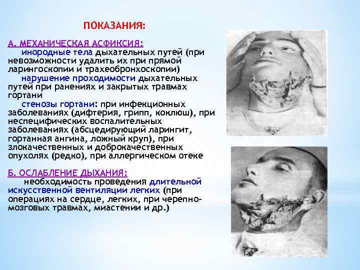 ПОКАЗАНИЯ: А. МЕХАНИЧЕСКАЯ АСФИКСИЯ: инородные тела дыхательных путей (при невозможности удалить их при прямой