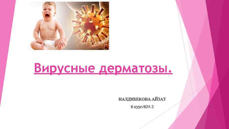 Вирусные дерматозы. НАЛДИБЕКОВА АЙЗАТ 6 курс/624 -2 