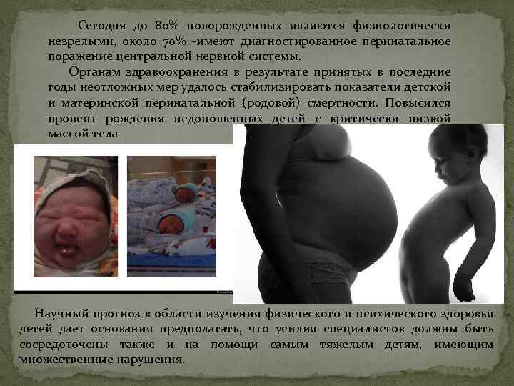 Сегодня до 80% новорожденных являются физиологически незрелыми, около 70% -имеют диагностированное перинатальное поражение центральной