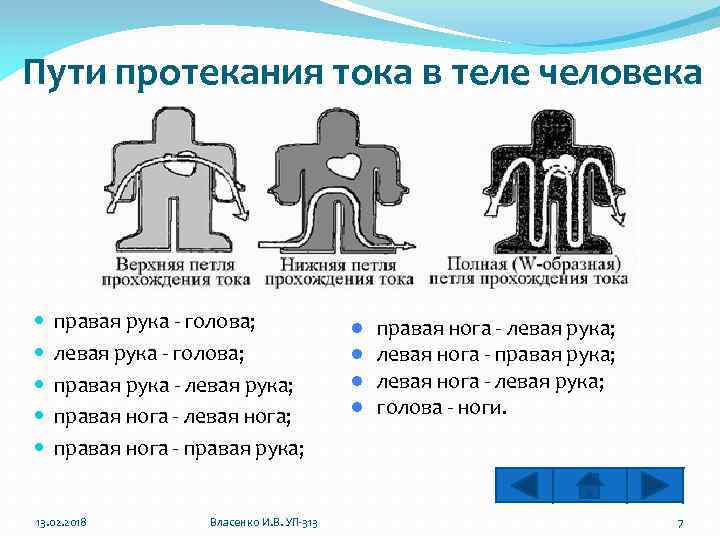 Пути протекания тока в теле человека правая рука - голова; левая рука - голова;