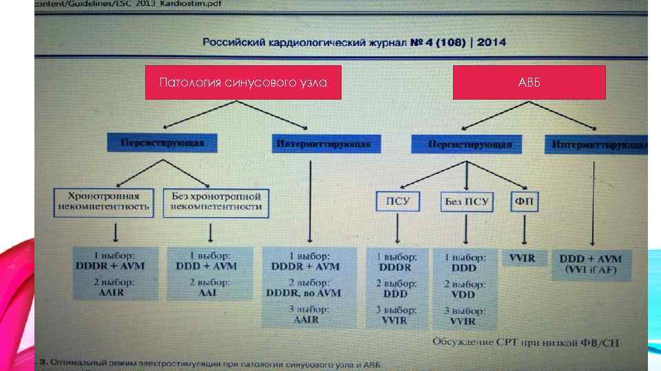 Патология синусового узла АВБ 