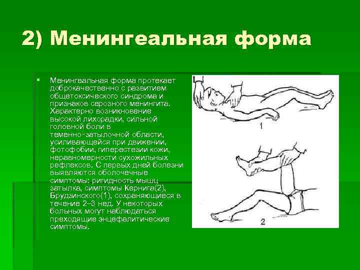 2) Менингеальная форма § Менингеальная форма протекает доброкачественно с развитием общетоксического синдрома и признаков