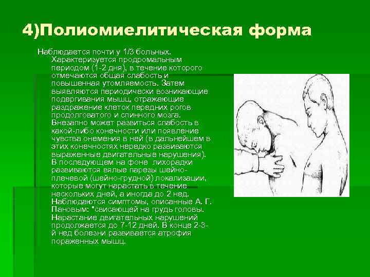 4)Полиомиелитическая форма Наблюдается почти у 1/3 больных. Характеризуется продромальным периодом (1 -2 дня), в