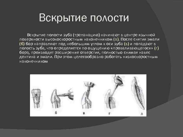 Определение полости. Трепанация коронки интактного зуба это. Вскрытие полости интактного зуба. Этапы вскрытия полости зуба. Раскрытие полости зуба.